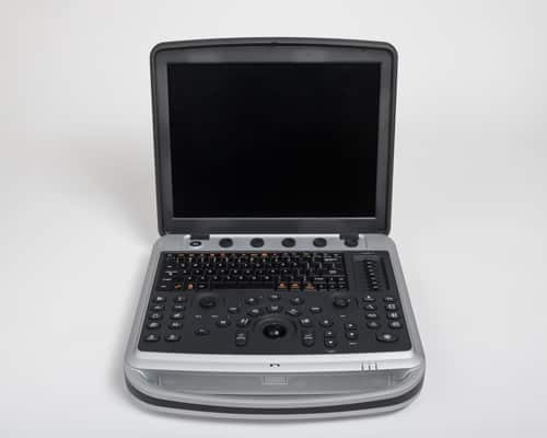 Chison Sonobook 9 laptop ultrasound machine