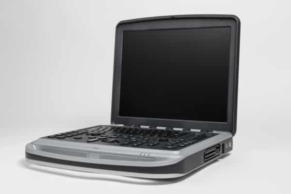 Chison SonoBook 9 right side view