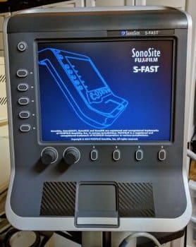 sonosite s-series ultrasound for sale